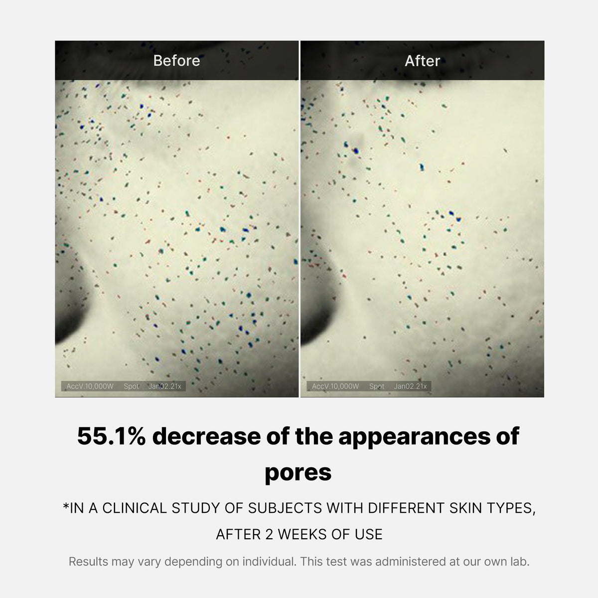 pore-care-duo-i6 05_12ddab8a-64be-4612-8ee1-27e5ec701921.jpg