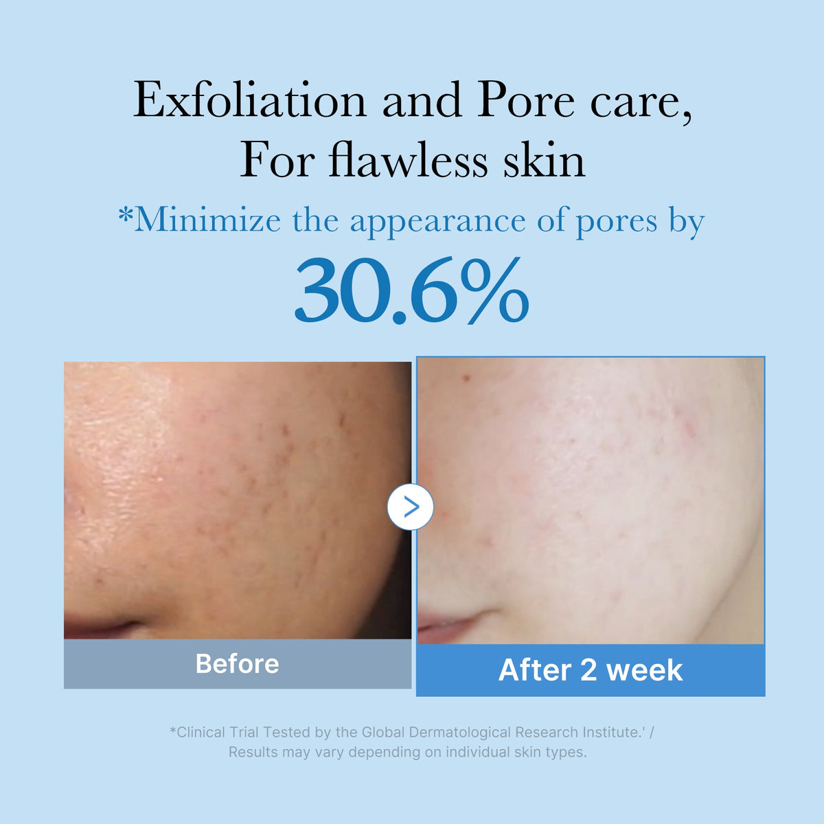 zero-pore-toner-b7 01_d6480b4e-3c08-4954-994a-ed5212c1839c.jpg