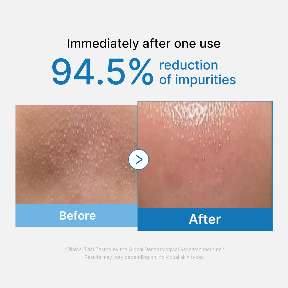 zero-pore-blackhead-deep-cleansing-oil-u6 01_eed557ec-5857-46a2-8b17-dbd67c692dcb.jpg