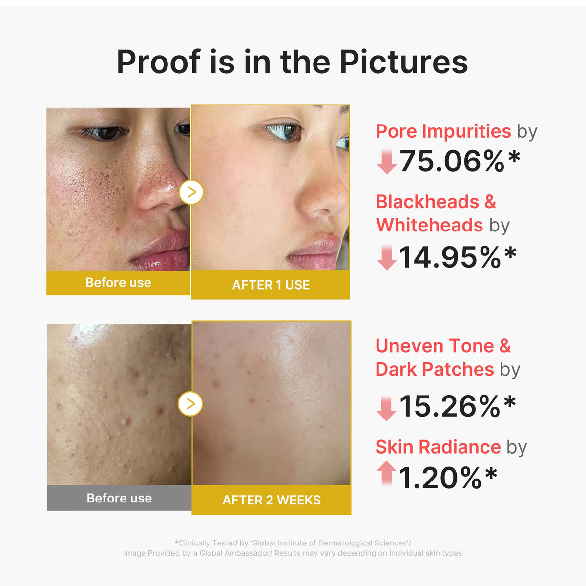 kojic-acid-turmeric-peel-shot-c9 02_45fe66d3-b3f6-4100-aa52-2afd7eded417.jpg