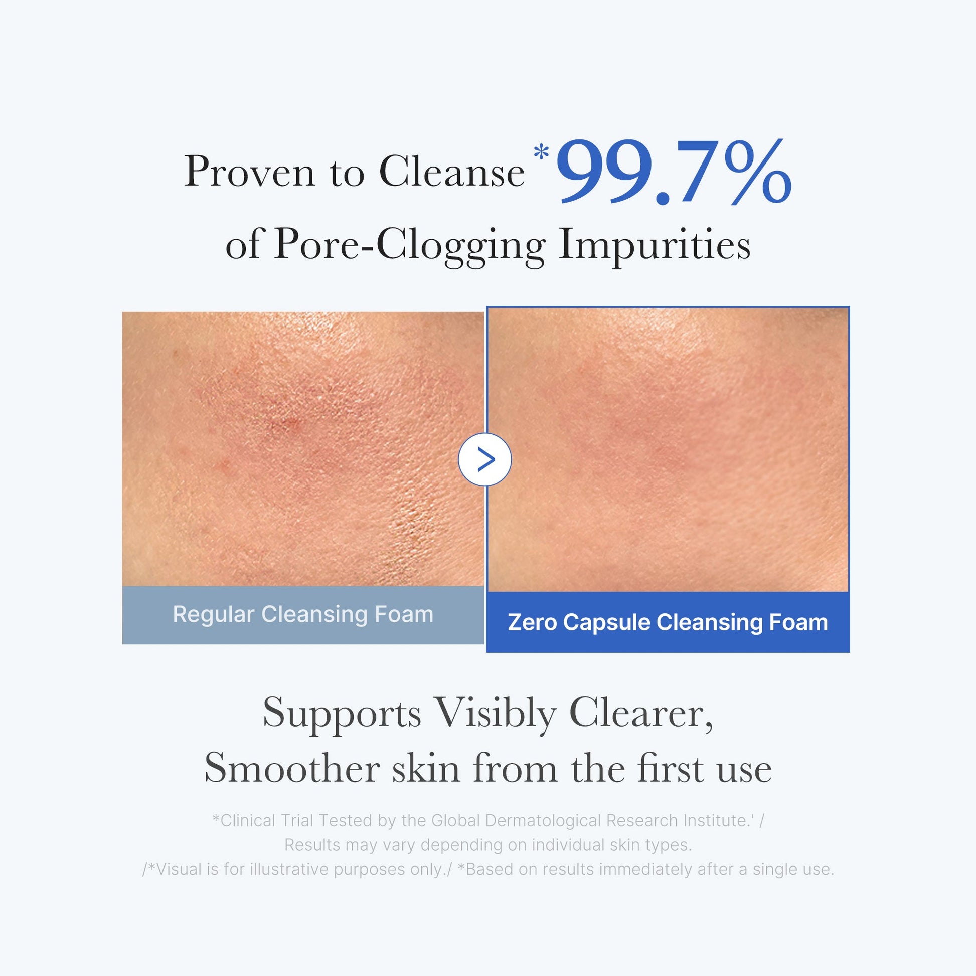 zero-pore-capsule-cleansing-foam-z2 02_c1fb9dfb-86c5-4038-8ff8-490d1006276c.jpg
