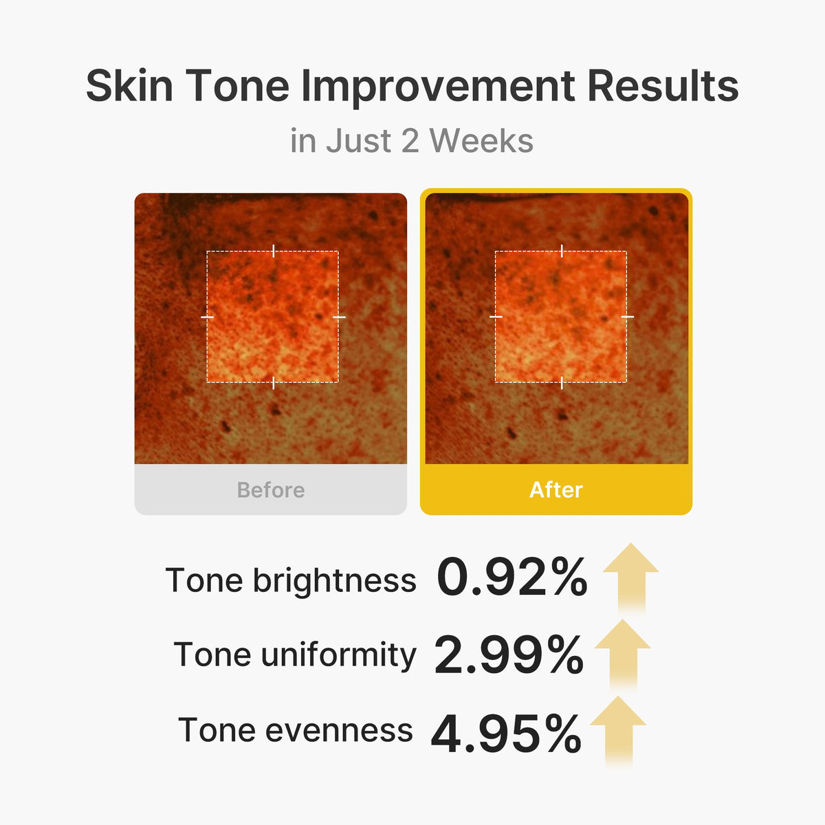 kojic-acid-turmeric-vita-capsule-cream-j6 03_2b626701-fc6c-4702-9e96-a2157a4f7f9d.jpg