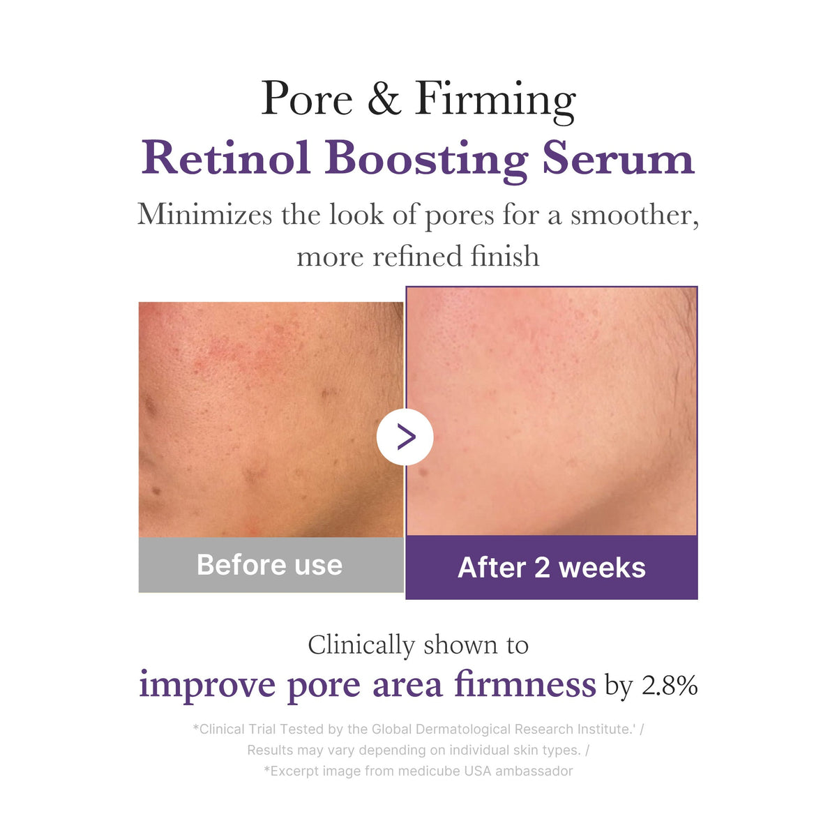 retinol-nmn-boosting-serum-f4 03_3510e7a5-5633-4a18-81ea-1389593bd517.jpg
