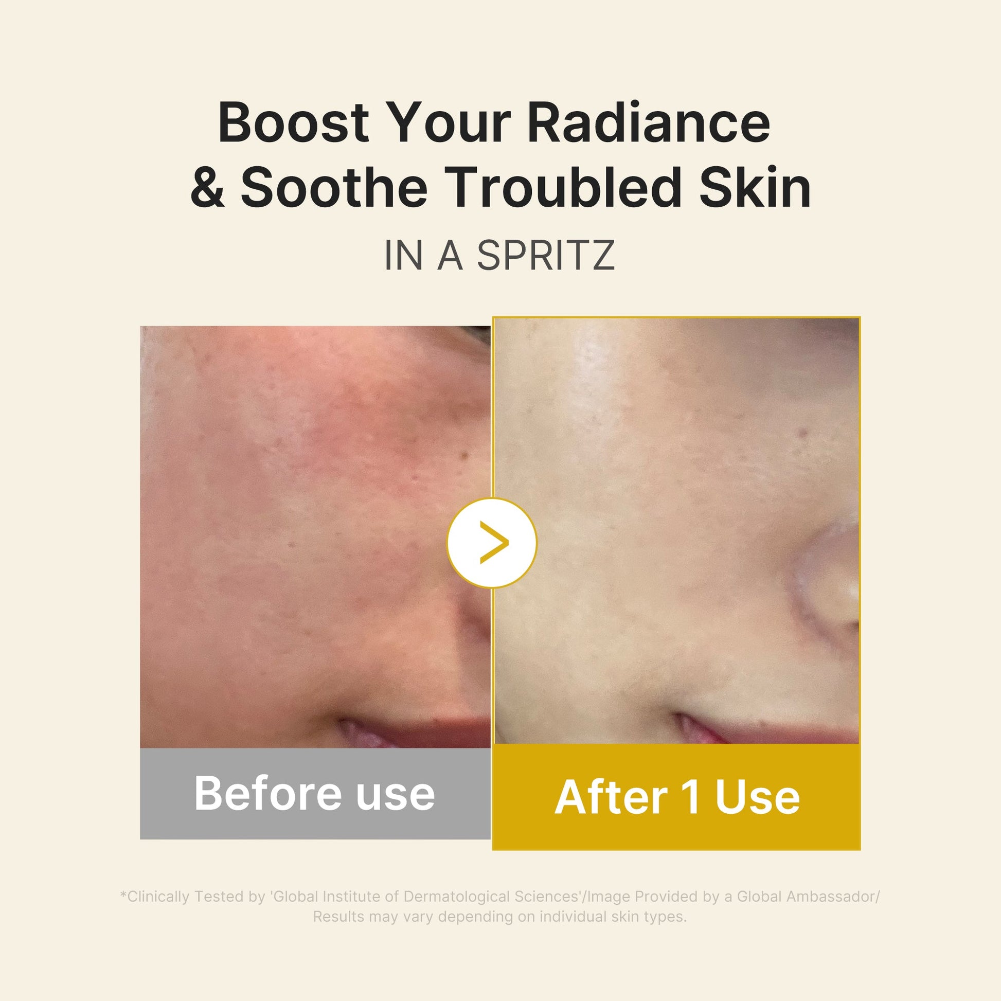 kojic-acid-turmeric-vitamin-gold-jelly-mist-serum-z5 03_dc9cd19e-4e57-49d3-9b66-c7762e8a63f1.jpg