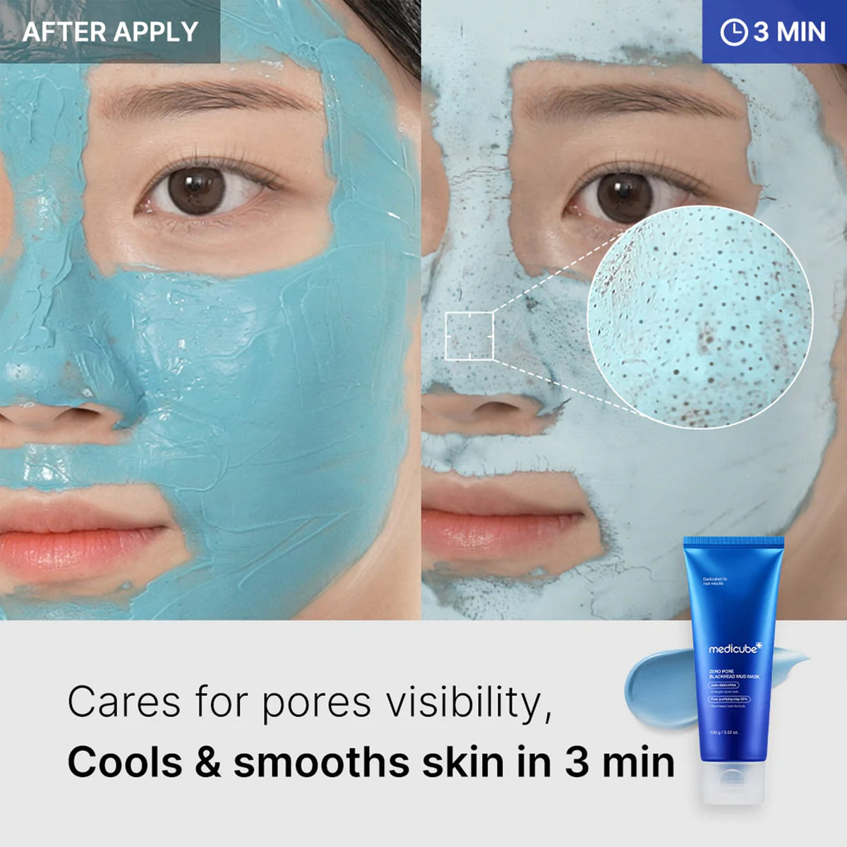 zero-pore-blackhead-mud-mask-y7 04_867c0459-a94e-40d3-bd9a-70400edabe8d.jpg
