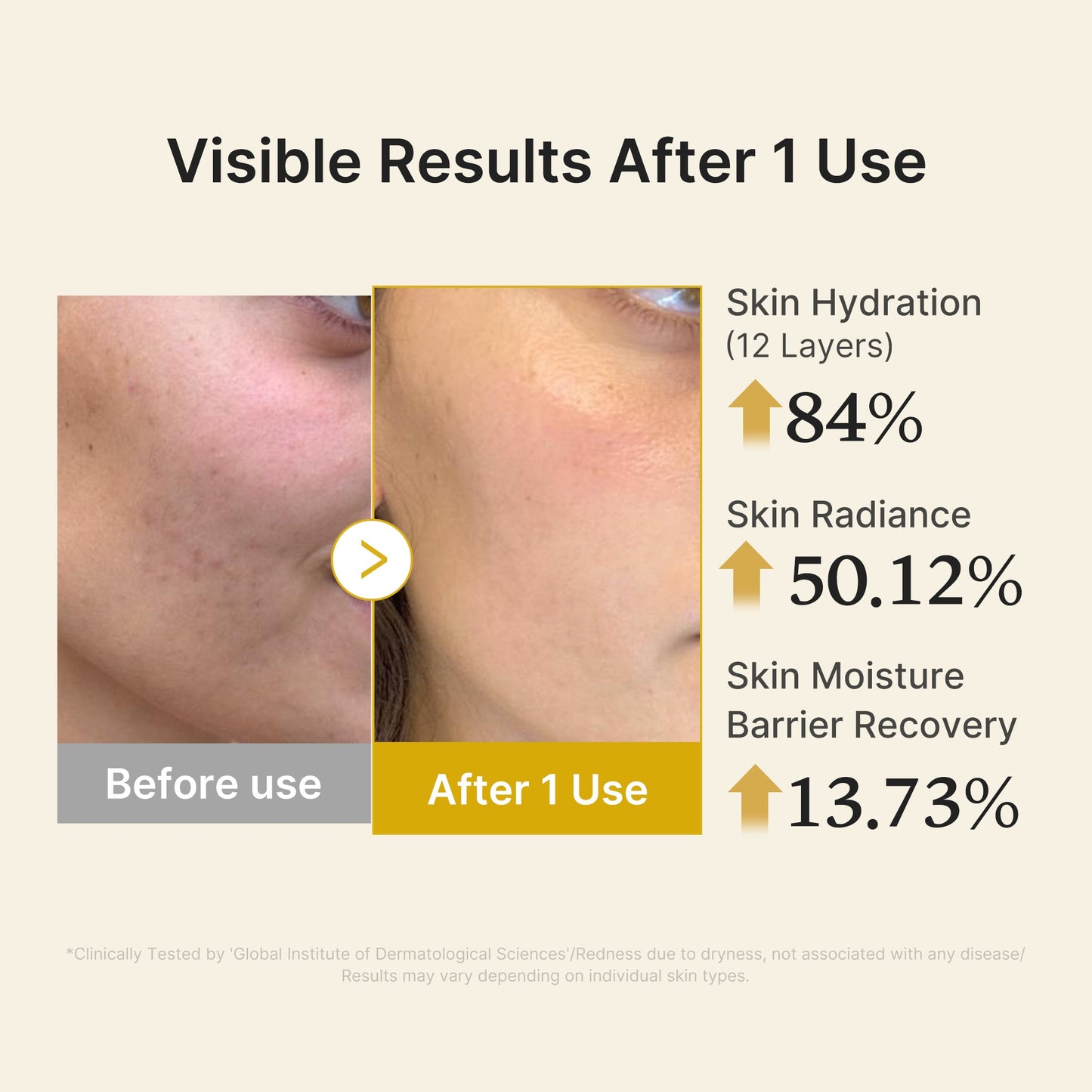 kojic-acid-turmeric-vitamin-gold-jelly-mist-serum-z5 04_d5c55ef1-e03b-494d-bc0d-a1ecc7fc2abf.jpg