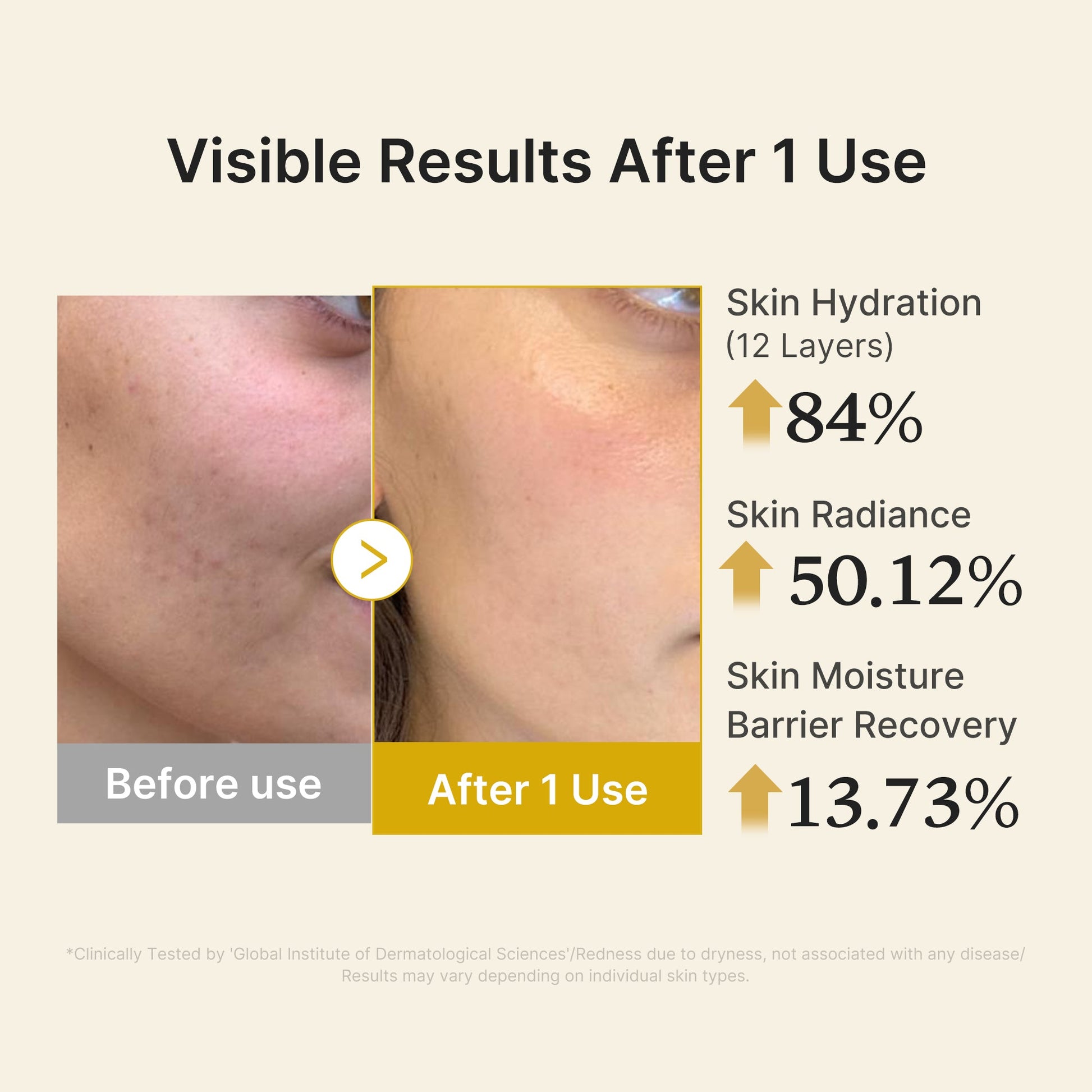 kojic-acid-turmeric-vitamin-gold-jelly-mist-serum-z5 04_d5c55ef1-e03b-494d-bc0d-a1ecc7fc2abf.jpg