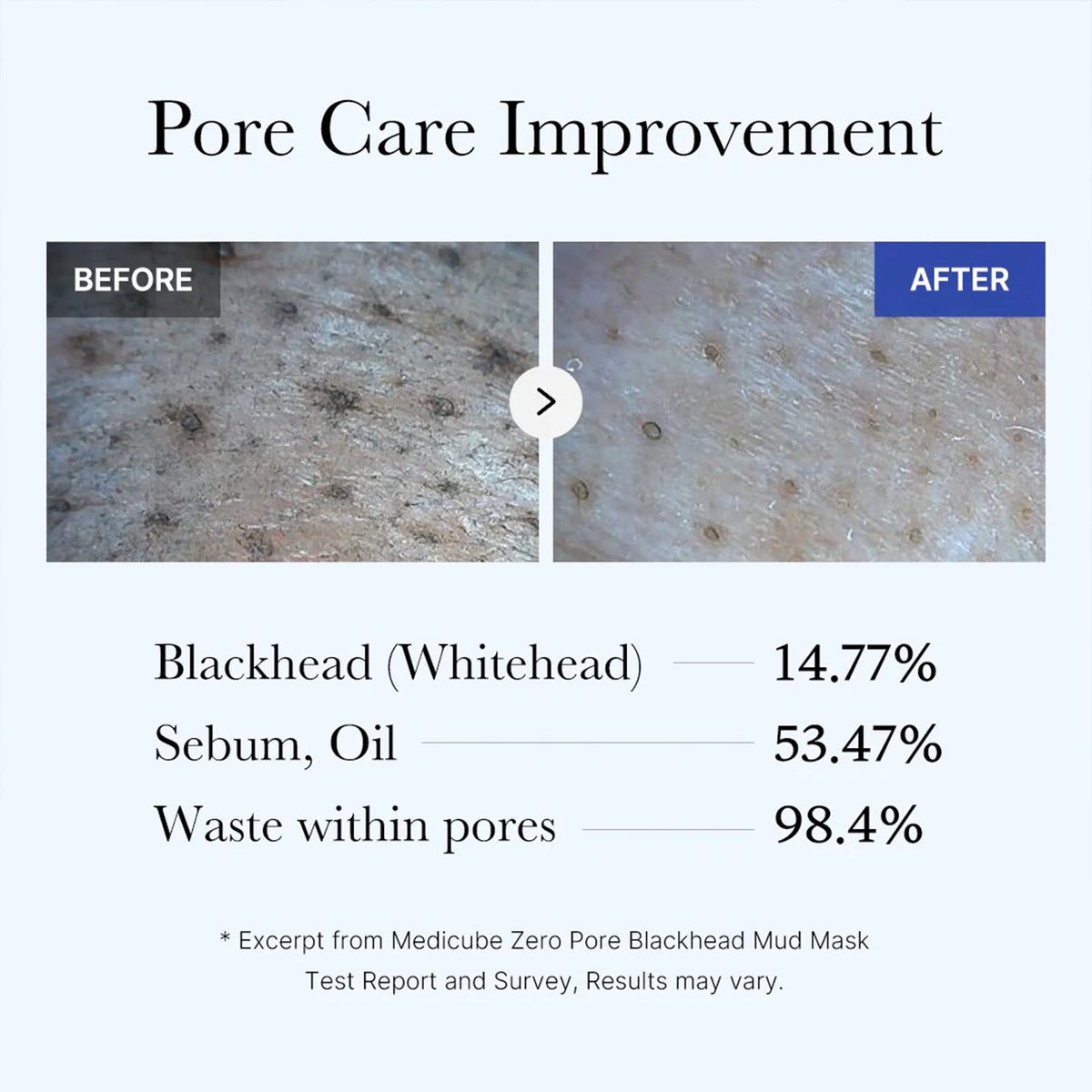 zero-pore-blackhead-mud-mask-y7 05_9362a158-c2b3-4525-acc0-631a2cfdea47.jpg