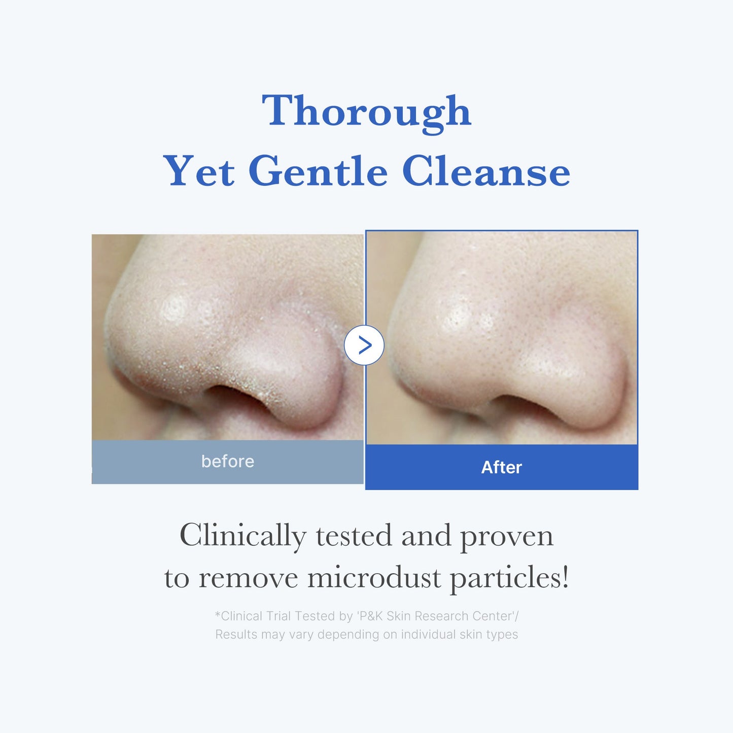 zero-foam-cleanser-f0 250702_ZeroCleanser3.jpg