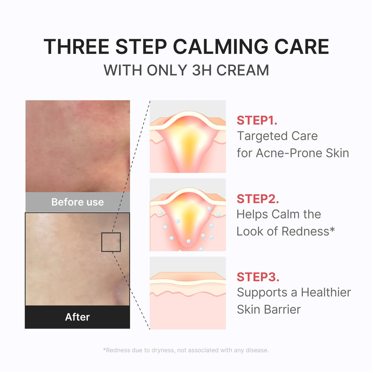 3h-daily-relief-cream-i4 3H_04.jpg