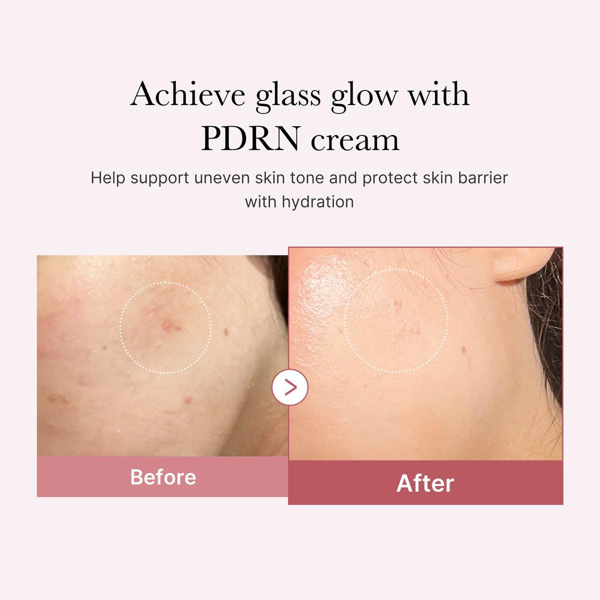 pdrn-pink-peptide-cream-a3 PDRN_02_d7805bfe-cf43-446a-b71b-a276683f136b.jpg