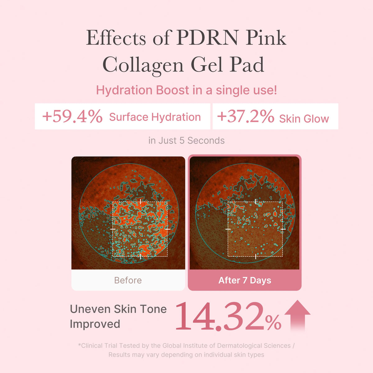 pdrn-pink-collagen-gel-toner-pad-y6 PDRN_04_f9a16a56-8d9e-4c47-a635-ed34ec3ed571.jpg