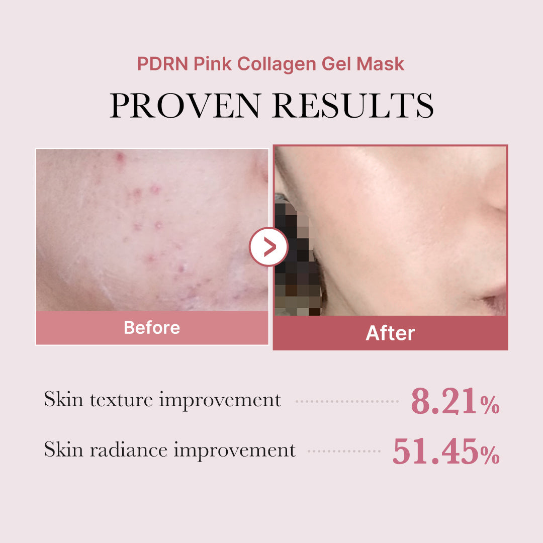 pdrn-pink-glow-full-set-k7 PDRN_12.jpg